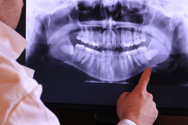 Best Emergency Dentist for Knocked-Out Tooth in Geneseo, IL