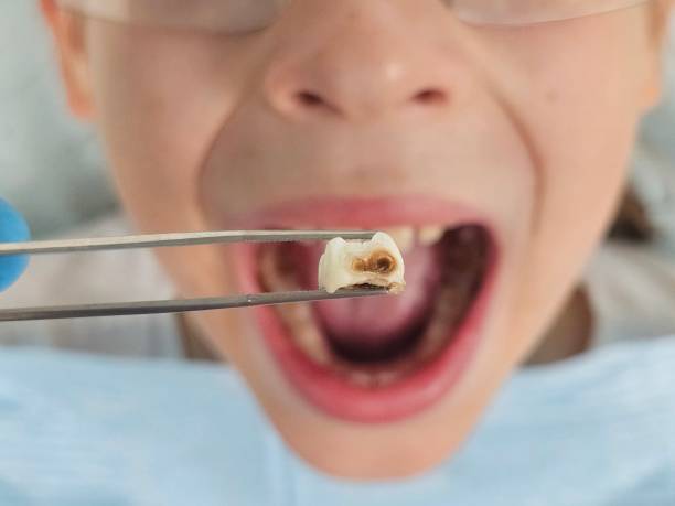 Best Orthodontic Emergency Dentist in Geneseo, IL