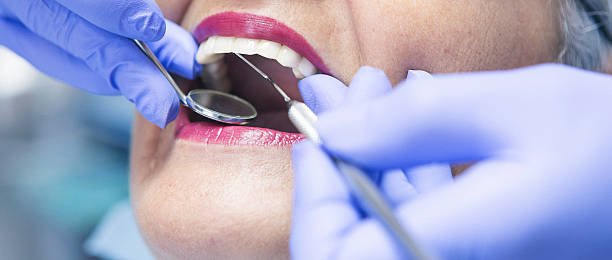 Best Emergency Dentist for Special Needs Patients in Geneseo, IL